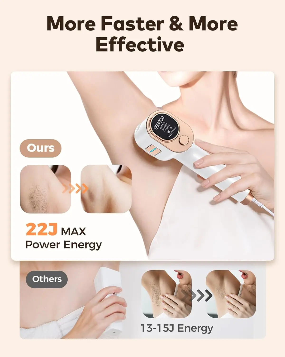 IPL At-Home Laser Hair Removal Device